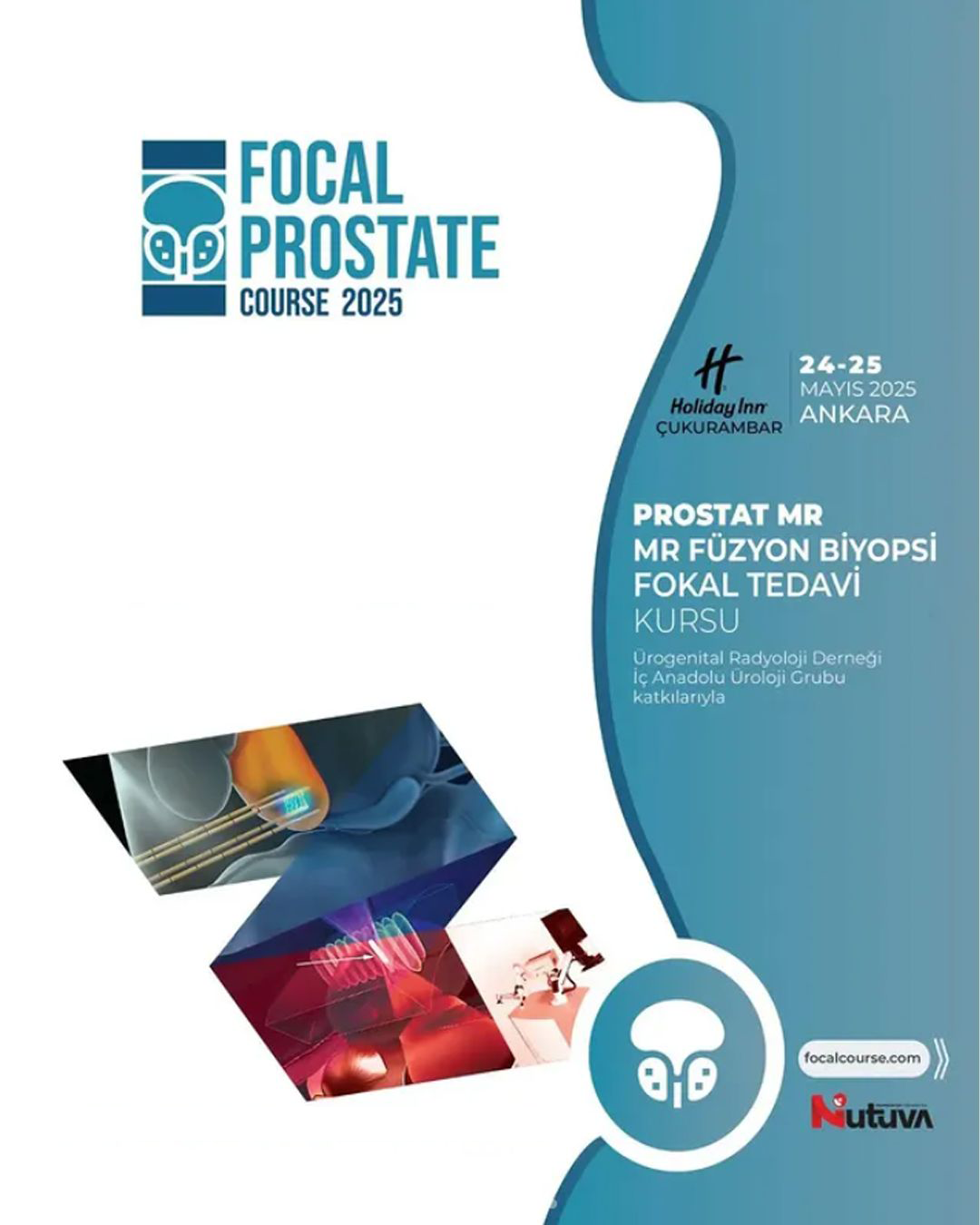Focal Prostate Kursu
